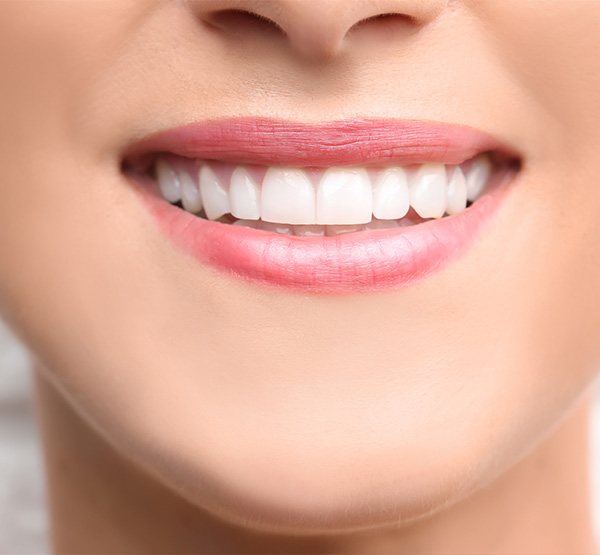 Closeup of beautiful smile after cosmetic dental bonding