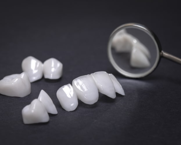A variety of metal free dental restoration options