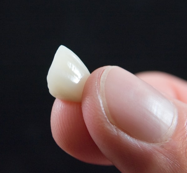 Person holding piece of broken tooth