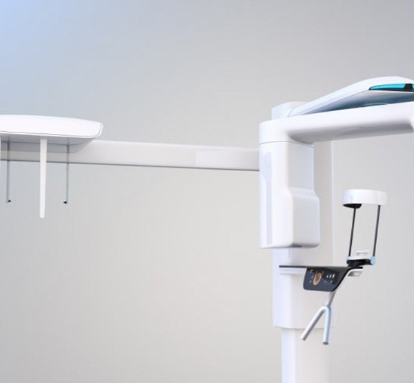 3 D C T cone beam digital x-ray scanner