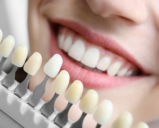 Dudley cosmetic dentist shade matching patient's teeth